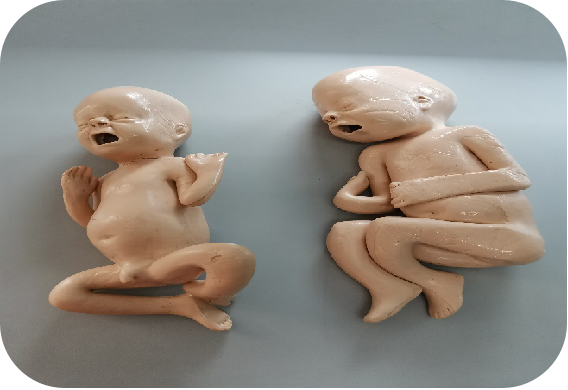 高级婴儿插管模型